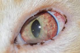 Image result for Uveitis