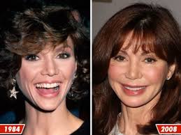 Victoria principal has ruled out a return to dallas. Victoria Principal Good Genes Or Good Docs