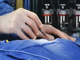 See full list on mesothelioma.net Lung Sparing Surgery May Boost Mesothelioma Survival