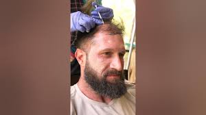 This SAVED my Hair! #stemcells #hairloss #hairgrowth