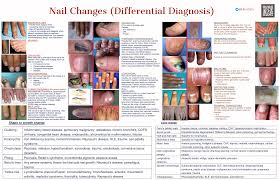 Image result for Muehrcke Line