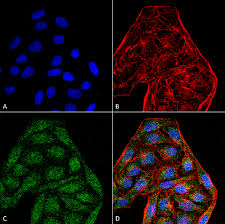 The camel igg presented as two bands with molecular masses of 250 and 100 kda, the latter corresponding to heavy chain igg, on 10% gel electrophoresis. Anti Cd74 Antibody Mybiosource