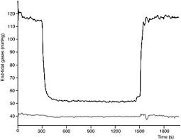 Image result for End-Tidal O2