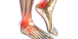 Dbth vfc medial malleolus fracture. Sehnenentzundung Am Knochel