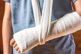 العلاج الطبيعي ضروري بعد كسور العظام هذه أضرار إهماله الكونسلتو