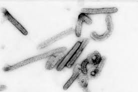 No antiviral medications have proved effective in treating infection with either ebola virus or marburg virus. Swzkvee0y2d04m