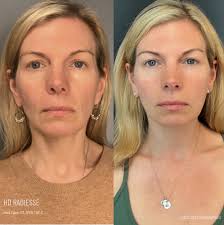 Holly Tabor, MS, APRN, FNP-C