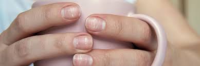 Image result for Mees Line