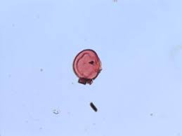 Image result for Pentarhopalopilia umbellulata