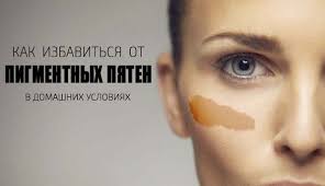как убрать пигментные пятна на лице в домашних условиях отзывы Pigmentnye Pyatna Na Lice I Na Kozhe Pochemu Oni Poyavlyayutsya I Kak Ot Nih Izbavitsya