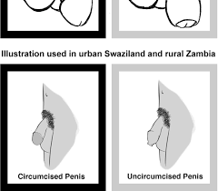 Figure 2 from The (Mis)Reporting of Male Circumcision Status among Men and  Women in Zambia and Swaziland: A Randomized Evaluation of Interview Methods  | Semantic Scholar