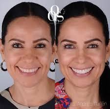 AOS Dental Clinic (@aosdentalclinic) · Instagram 照片和视频