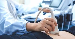 Sep 10, 2020 · september 10, 2020. Baby Heart Rate And Gender Predicting The Sex