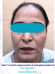 🌿 A Skin Journey Built