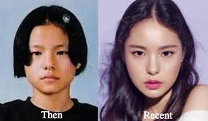 5 Artis Korea Ini Jujur Pernah Operasi Plastik Ini Fotonya Kincir Com