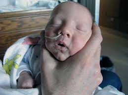 calvin's story: January 2012