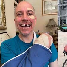 Fundraiser for Steven Smallwood by Steven Smallwood : Cycling accident
