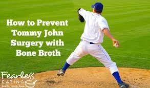 Tommy john surgery, more formally known as ulnar collateral ligament (ucl) reconstruction, is used to repair a torn ulnar collateral ligament inside the elbow. How To Prevent Tommy John Surgery With Bone Broth Fearless Eating