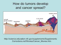 Effective treatment is possible in many cases. Outline What Is Cancer How Do People Know They Have Cancer Ppt Download