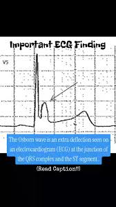 Image result for J Wave