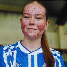 INCREDIBLE 👏 After Kilmarnock were forced to remove their announcement  post for a new signing, the 16 year old footballer had something to say...  Skye's response 🗣️ "I will let my football