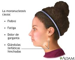 Qvision Documentado por primera vez un caso de necrosis retiniana aguda causado por virus de Epstein-Barr. images?q=tbn:ANd9GcQmEWmdFQgf8uGQdRpOZmOeiLULVpVqEkwLIBNPD 9q