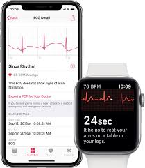 App Marsh On Apple Watch Ecg App Apple Watch Features
