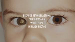 What causes an allergic reaction? Smartphones Can Detect Eye Cancer The Verge