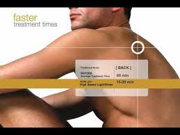 On a scale of 1 to 10 most patients rate it at a 3 to 4. Laser Hair Removal San Diego La Jolla Laser Hair Removal