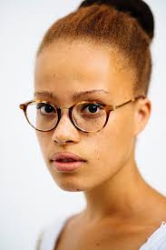 Here's what you need to know ginger isn't considered a common medical treatment for keeping hair healthy, but some claim anecdotally that this spice may improve hair growth. Photographer Explores The Beautiful Diversity Of Redheads Of Color Huffpost