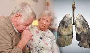 These symptoms can still be a sign of lung cancer because lung cancer usually does not cause. Cancer Symptoms The Warning Signs A Tumour Has Developed In The Lungs Full List Express Co Uk