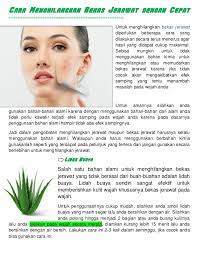 Pertama sekali, dengan menggunakan krim rawatan yang kebiasaannya mengandungi gabungan glikolik dan asid salisilik. Cara Menghilangkan Bekas Jerawat Dengan Cepat