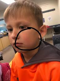 Anyone else having problems with Stemmers Run Middle? My son within the  first month of school has his nose broke by another student during first  period. The school never called me and