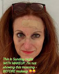 HAPPY EASTER! 🐇 I was finally recovering from cellulitis (from falling