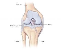 Formed in 1986, the laboratory is a regional asset and resource for physicians and patients living and working in the service area. Acl Reconstruction Surgery Temple Health