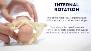 Image result for Manual Rotation in Occipitoposterior Presentation