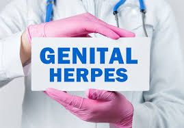Image result for genital herpes