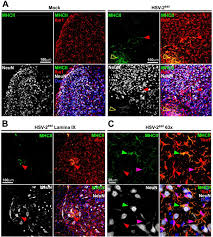 Hsl (hue, saturation, lightness) and hsv (hue, saturation, value, also known as hsb or hue, saturation, brightness) are alternative representations of the rgb color model. Analysis Of Als Related Proteins During Herpes Simplex Virus 2 Latent Infection Journal Of Neuroinflammation Full Text