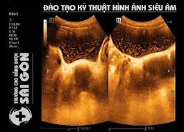 Đi học đi làm gia đình. Há»c Chuyá»ƒn Ä'á»•i Vb2 Cao Ä'áº³ng Kt Hinh áº£nh Y Há»c Sai Gon á»Ÿ Ä'au