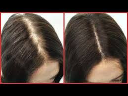 Whether you shave or you don't, it remains the same almost all the time. How To Regrow Hair On Bald Spot Edges Thinning Hair Fast Hair Growth Khichi Beauty Youtube Regrow Hair Hairstyles For Thin Hair Hair Growth Faster