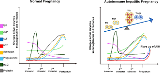 Autoimmune hepatitis (aih) is when the bodies immune system starts attacking your liver cells. Frontiers Autoimmune Hepatitis Tolerogenic Immunological State During Pregnancy And Immune Escape In Post Partum Immunology