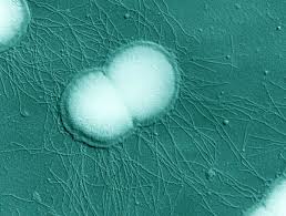 Worst-Ever' Case Of Super-Gonorrhea Detected In U.K. Man