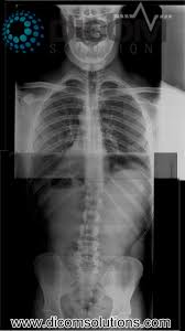 Example Digital X Ray Image With Chiropractic Tools Call 1 800 377 2617 Or Visit Www Dicomsolutions Com For More Information X Ray Images Image Movie Posters