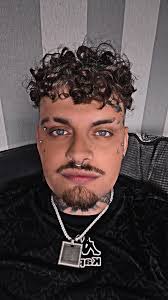 What should i go for next im not wanting to over do my face but more could  work, I'm booked in for over 26 dermals down my spine wanting some ideas for