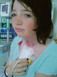 Teen sweethearts' lightning drama leads to hero rescue