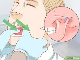 Image result for Jaw Dislocation