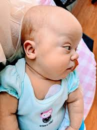 Baby's white blood cell count increasing with neutrophils