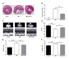 Towards your back, though, is your right kidney, which makes your urine. Semi Minimal Invasive Method To Induce Myocardial Infarction In Rats And The Assessment Of Cardiac Function By An Isolated Working Heart System Protocol