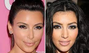 Consult a doctor if the hair growth is accompanied by other masculine features like deepening voice, decreased breast size, increased muscle mass, etc. How Facial Hair Removal Keeps Kim Kardashian Young Laser Hair Removal Face Hair Removal Diy Facial Hair Removal