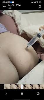 Butt injection - video 46 - ThisVid.com
